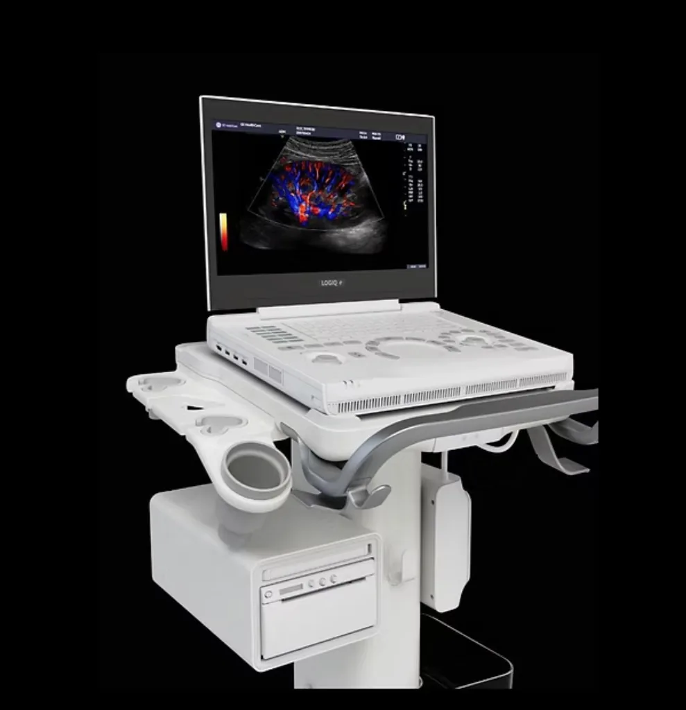 Ultrasound Scanner